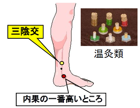 腹圧性尿失禁のツボ